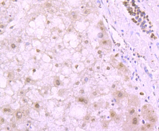 Anti-Tri-methyl-Histone H4 (Lys20) Antibody (5D958)