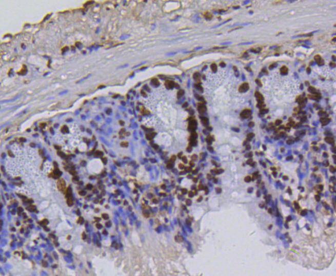 Anti-Acetyl-Histone H4 (Lys5) Antibody (9C227)