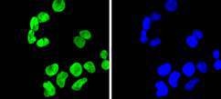 Anti-Di-methyl-HIST1H3A (Lys9) Antibody (6Y164)