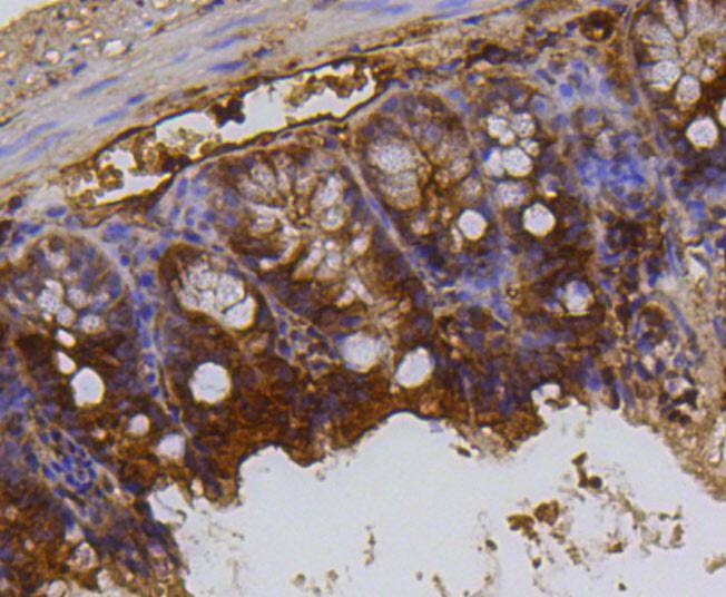 Anti-Mono/Di-methyl-HIST1H3A (Lys79) Antibody (2D87)