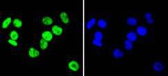 Anti-HNRNPC Antibody (2T80)