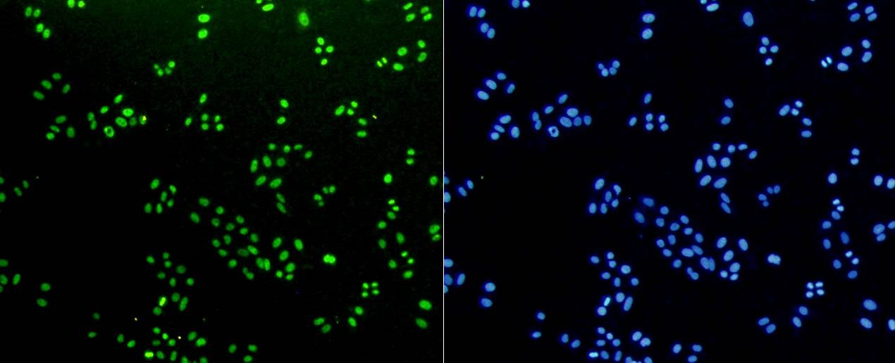 Anti-Mono-methyl-HIST1H3A (Lys18) Antibody (6Y799)
