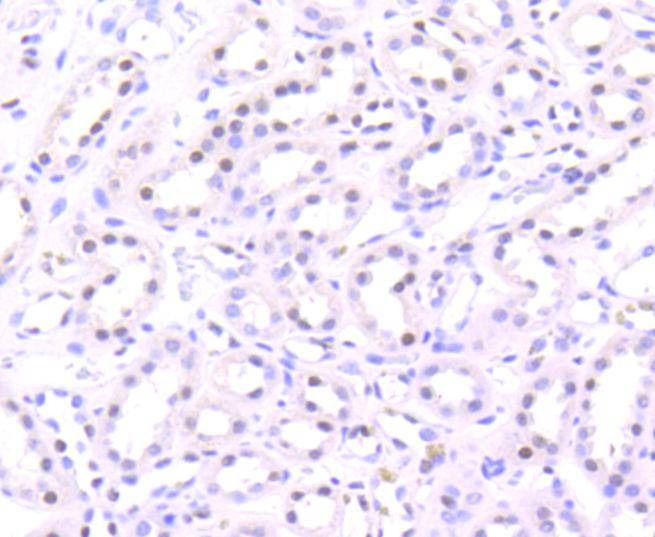 Anti-Acetyl-HIST1H3A (Lys56) Antibody (4S839)