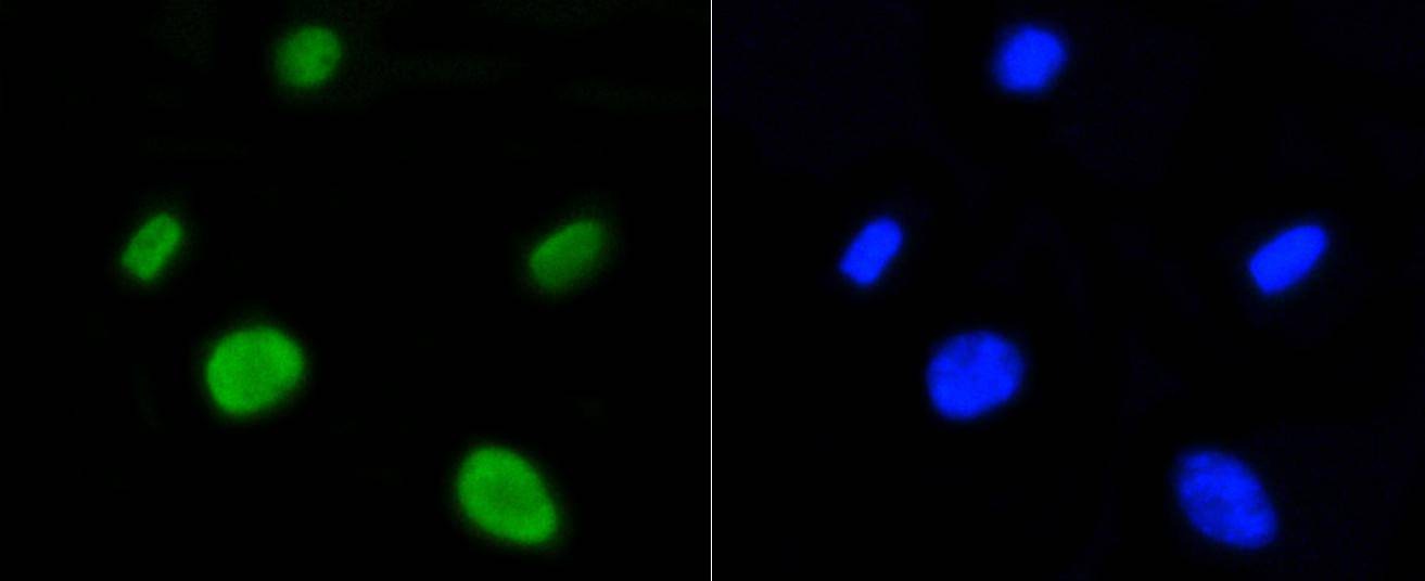 Anti-Acetyl-Histone H4 (Lys5) Antibody (9C227)