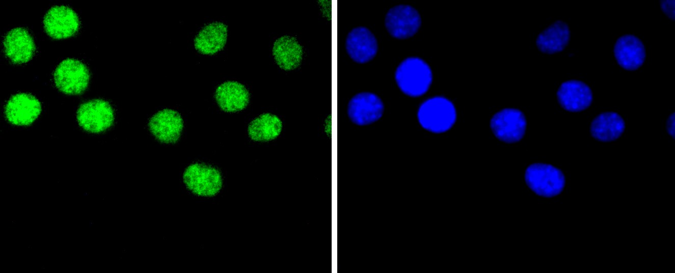Anti-HNRNPC Antibody (2T80)