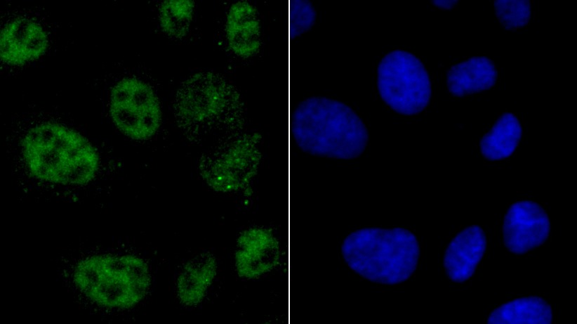 Anti-HNRNPA1 Antibody (4Q19)