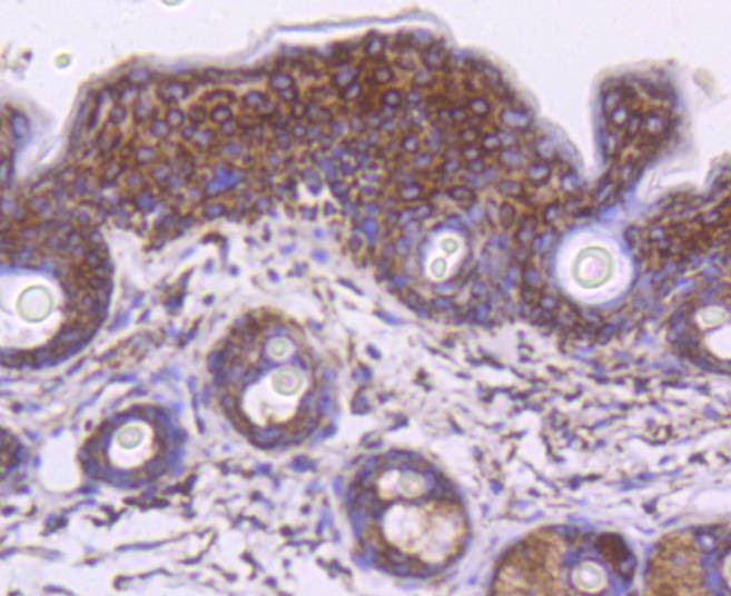 Anti-HSPD1 Antibody (4J857)