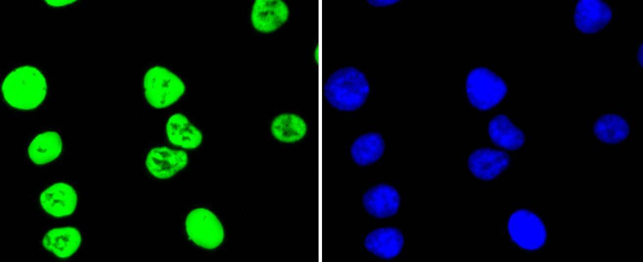 Anti-Acetyl-HIST1H3A (Lys56) Antibody (4S839)