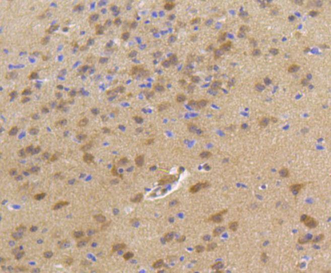 Anti-HSP70 Antibody (7N158)