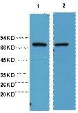 Anti-HSP70 Antibody (4V228)