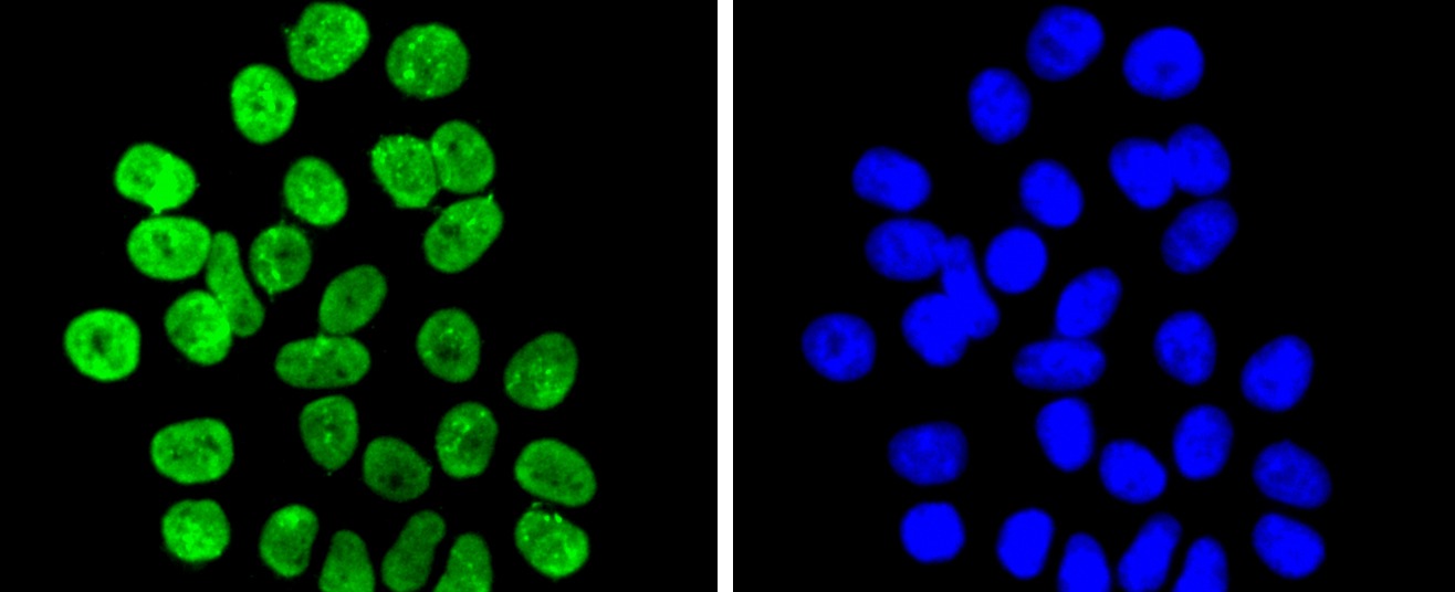 Anti-Di-methyl-HIST1H3A (Lys9) Antibody (6Y164)