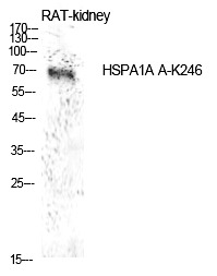Anti-Acetyl-HSP70 (Lys246) Polyclonal Antibody