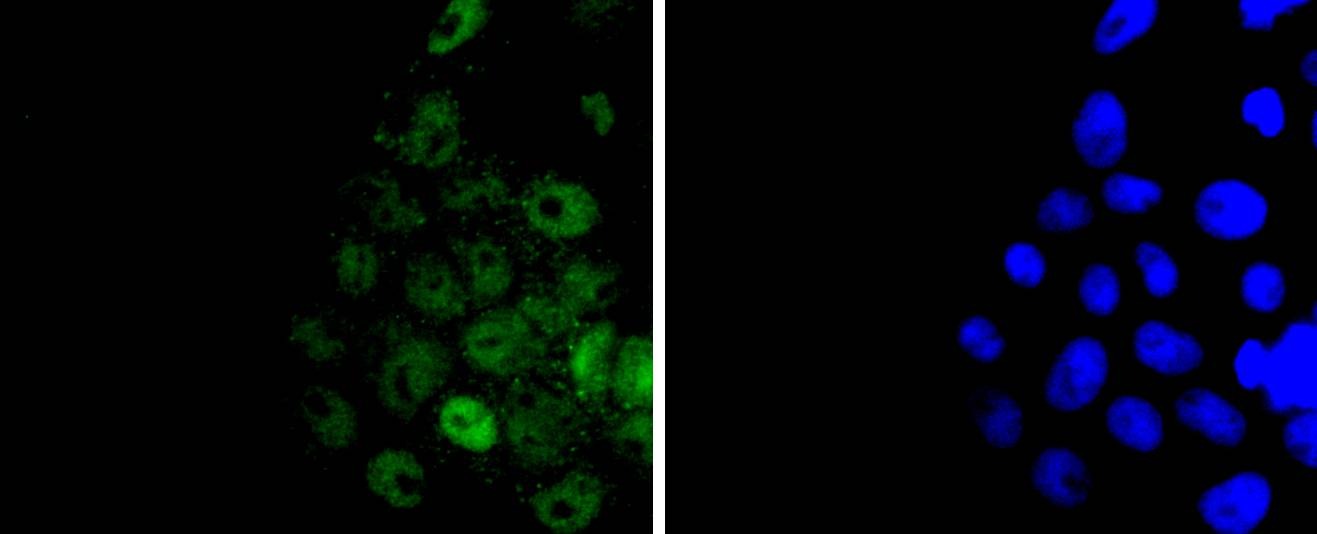 Anti-HIST1H3A Antibody (9H443)