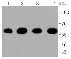 Anti-HSPD1 Antibody (4J857)