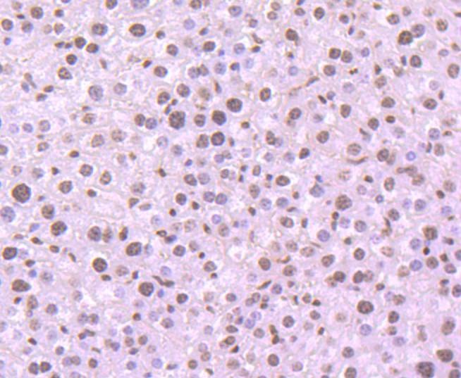 Anti-HIST1H3A Antibody (9H443)