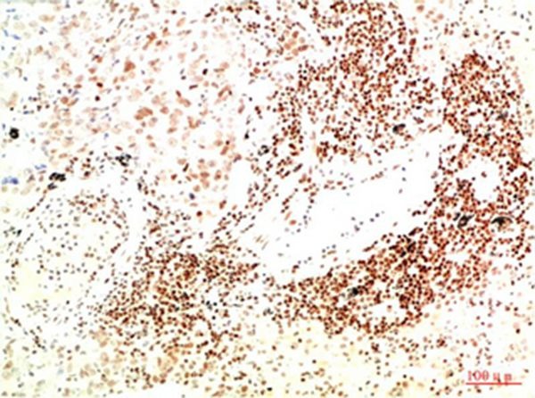 Anti-JAK2 Antibody (4H967)