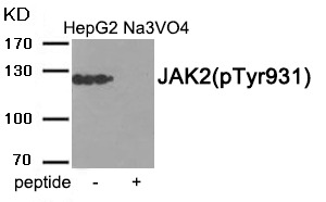 Anti-Phospho-JAK2 (Tyr931) Polyclonal Antibody
