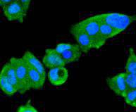 Anti-JAK2 Antibody (1B619)