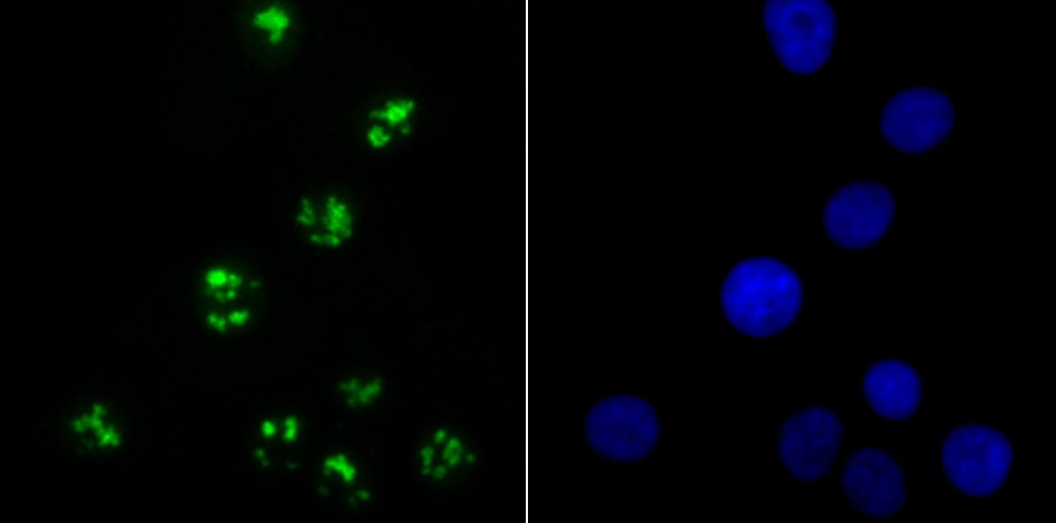 Anti-KDM5A Antibody (8P685)