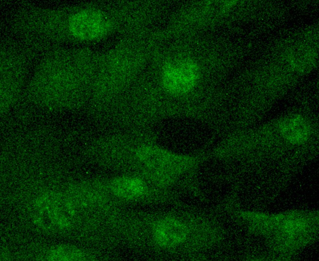 Anti-JAK2 Antibody (1B619)