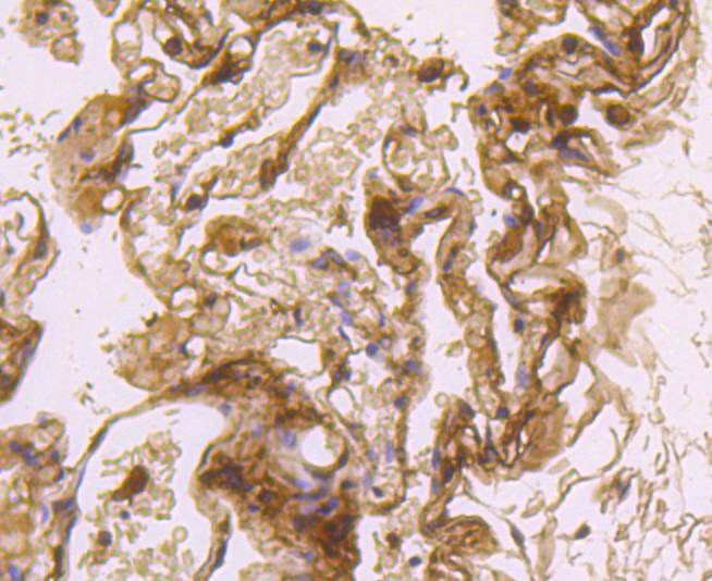 Anti-LDLR Antibody (1J54)