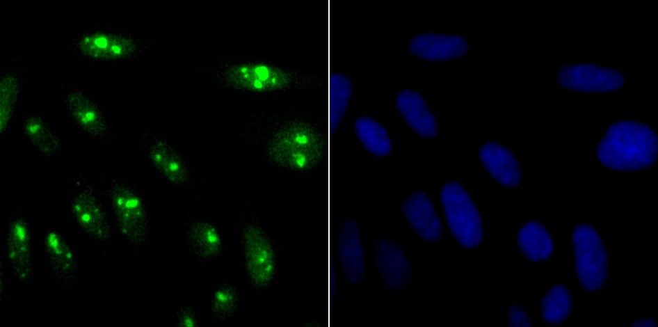 Anti-KDM5A Antibody (8P685)