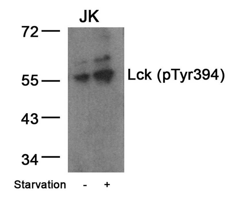 Anti-Phospho-Lck (Tyr394) Polyclonal Antibody