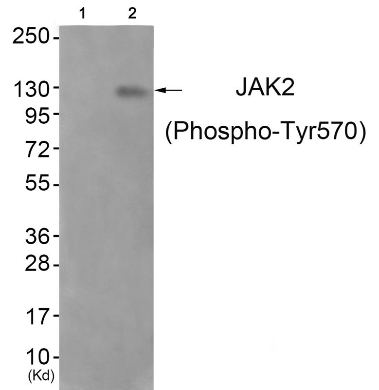 Anti-Phospho-JAK2 (Tyr570) Polyclonal Antibody