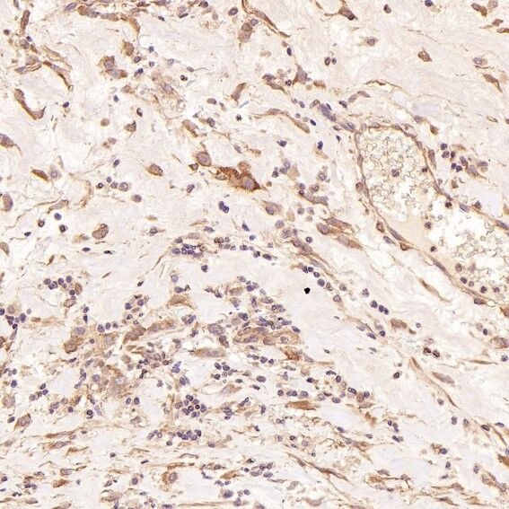 Anti-MAP1LC3B Antibody (7N270)