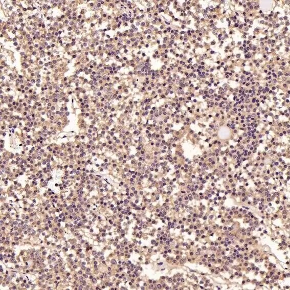 Anti-MAP1LC3B Antibody (7N270)
