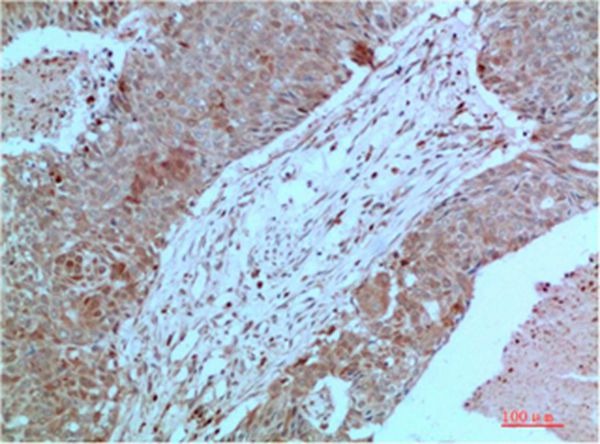 Anti-JAK2 Antibody (8S857)