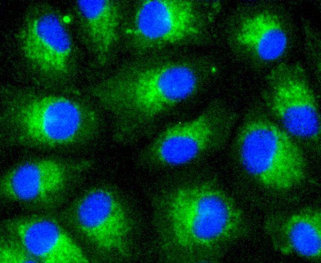 Anti-LDLR Antibody (1J54)
