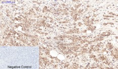 Anti-LTF/Lactoferrin Antibody (6J204)
