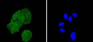 Anti-IRS-1 Antibody (6O938)