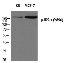 Anti-Phospho-IRS-1 (Tyr896) Polyclonal Antibody
