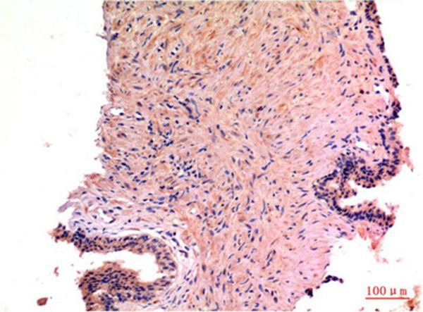 Anti-LC3A Antibody (5O401)