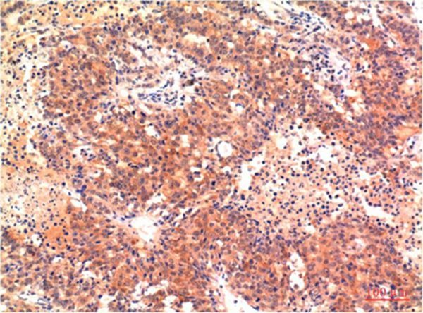 Anti-LC3A Antibody (5O401)