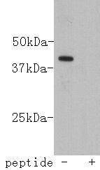 Anti-LASS2 Antibody (2U816)