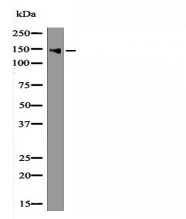 Anti-Phospho-LATS2 (Ser872) Polyclonal Antibody