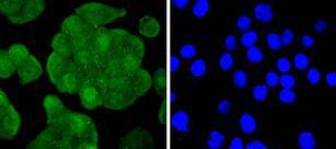 Anti-IRS-1 Antibody (6O938)