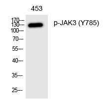 Anti-Phospho-JAK3 (Tyr785) Polyclonal Antibody 2