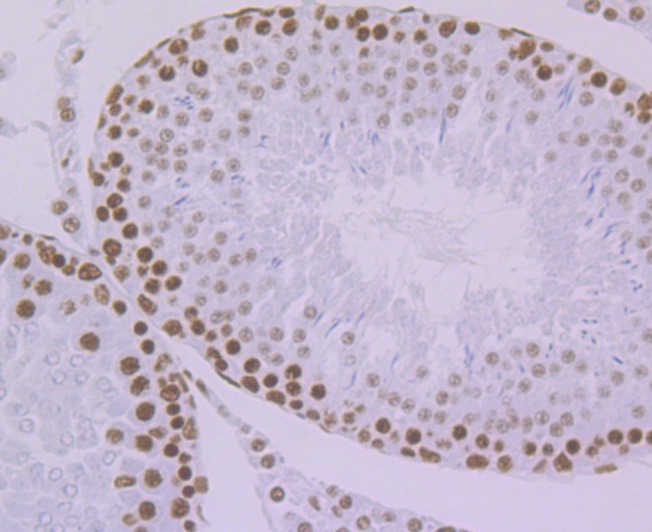 Anti-KHSRP Antibody (6L572)