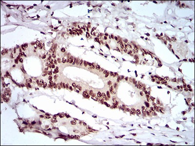 Anti-KHDRBS2 Antibody (3H737)