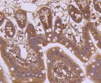 Anti-LAMB1 Antibody (6K439)