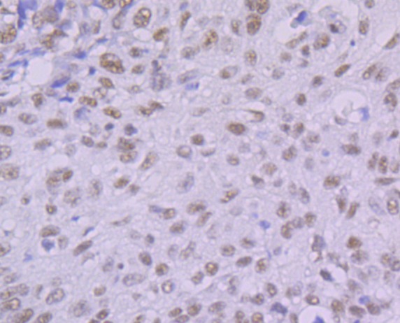 Anti-KHSRP Antibody (6L572)