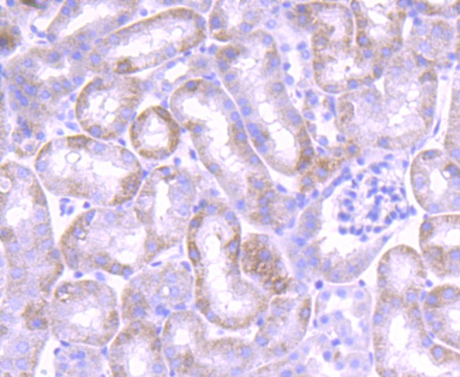 Anti-JAK1 Antibody (4O967)