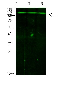 Anti-Phospho-JAK2/3 (Tyr966/939) Polyclonal Antibody 2