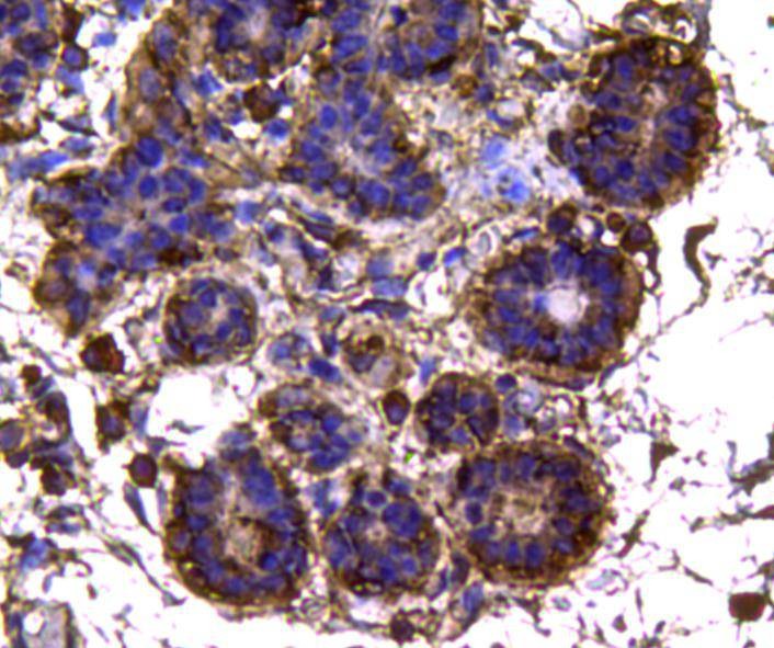 Anti-Isocitrate dehydrogenase/IDH1 Antibody (9Q57)