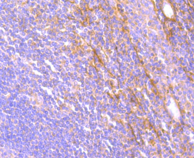 Anti-JAK3 Antibody (5S507)