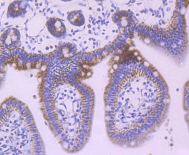 Anti-JAK1 Antibody (4O967)